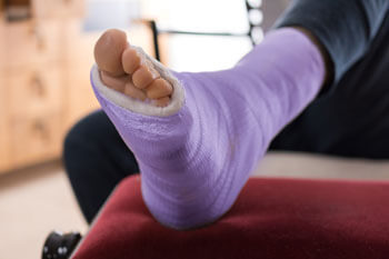 Foot Fractures treatment in the St. Charles, MO 63303 areas