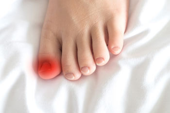 Ingrown toenails treatment in the St. Charles, MO 63303 areas