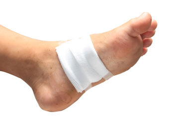 Diabetic Ulcers Treatment in the St. Charles, MO 63303 areas