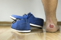 Why Foot Blisters Form While Running